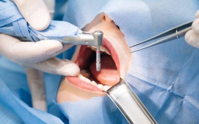 Agenda tu cita anual con el dentista