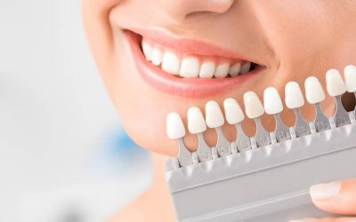 Recuerda usar el hilo dental