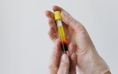 Plasma rico en plaquetas (PRP) en odontología regenerativa