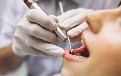 Qué es la periodontitis dental y cómo prevenirla a tiempo